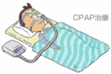 CPAP