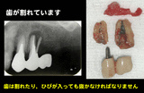 rootfrt
