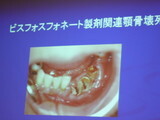 P1000189